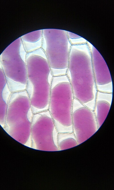 植物细胞质壁分离图片
