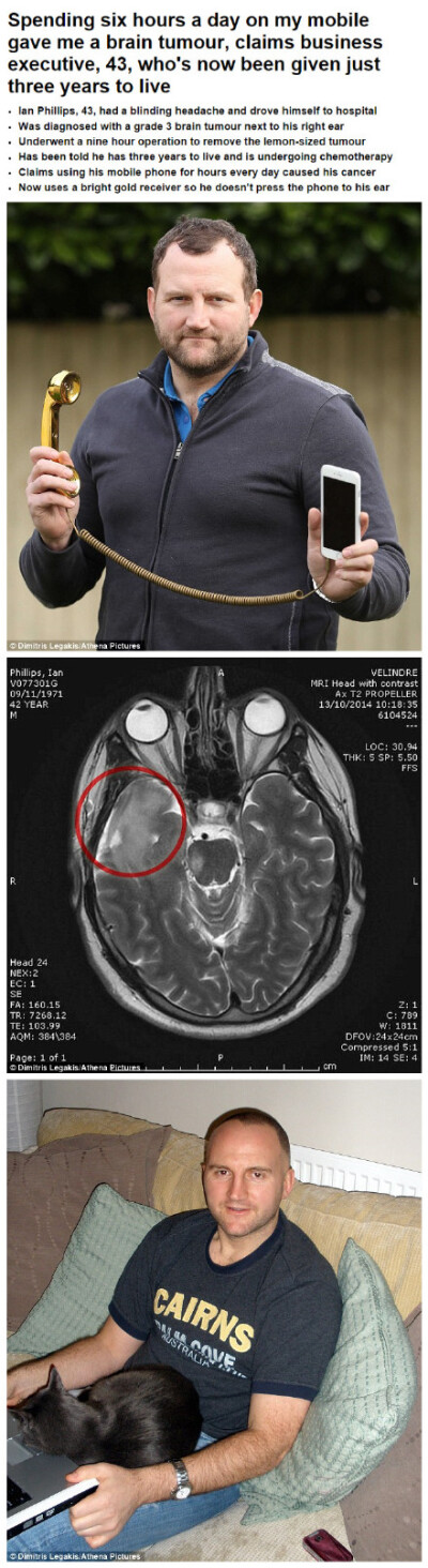 英国男子ian philips,确诊脑癌,脑部接近耳朵处有肿瘤,只有3年的寿命