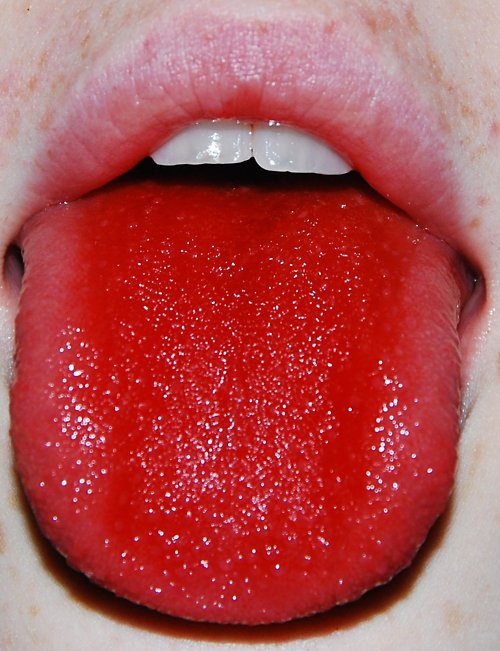 红舌头
