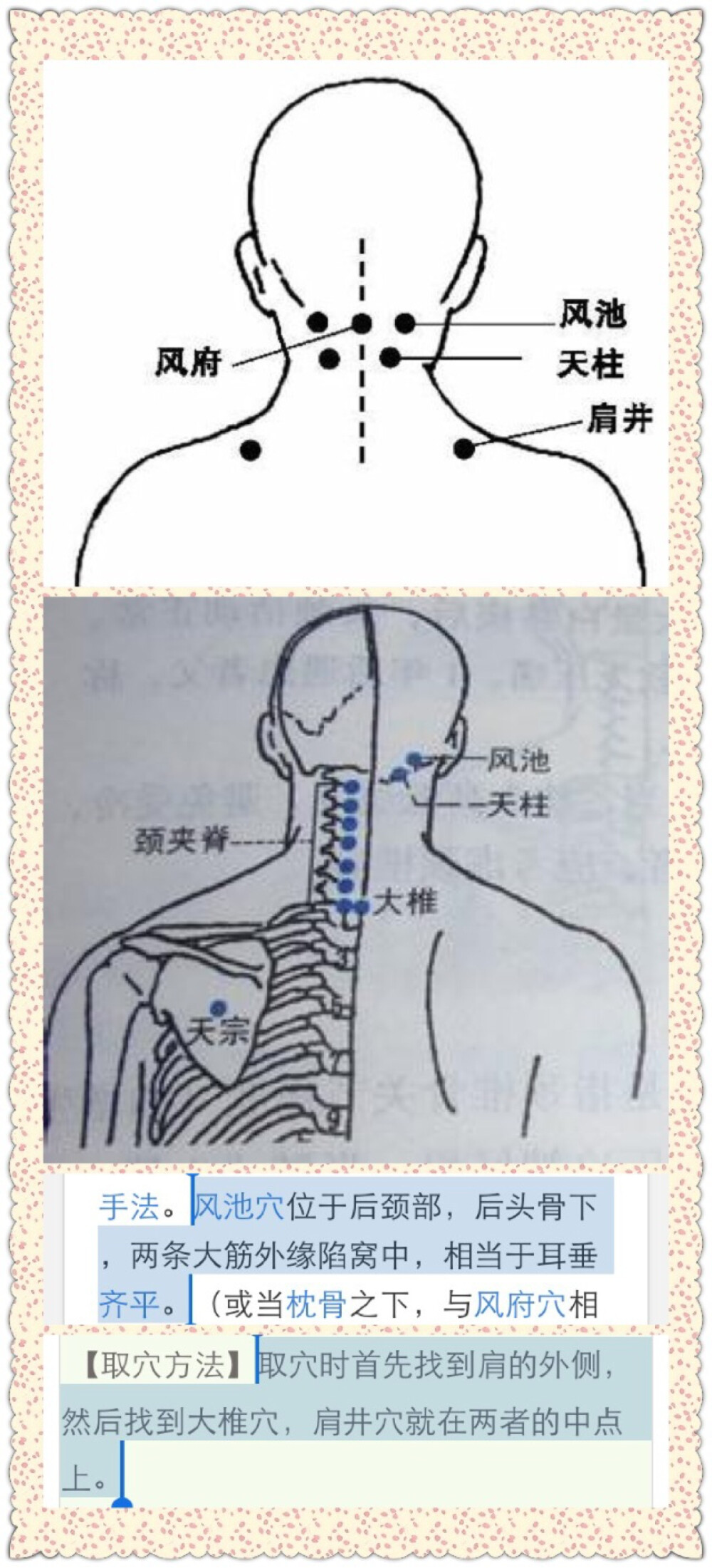 颈椎疼刮痧刮哪里图解图片