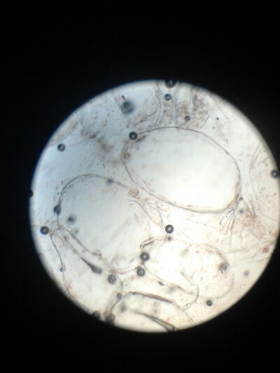番茄果肉细胞显微图图片