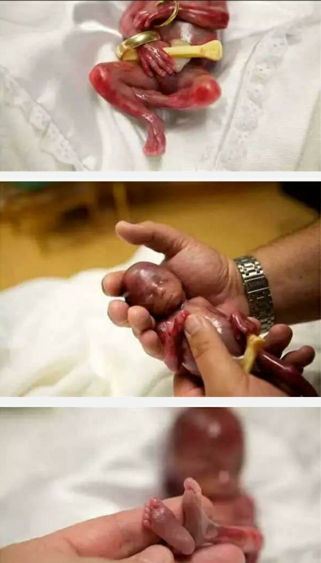 怀孕十九周胎儿真实图图片