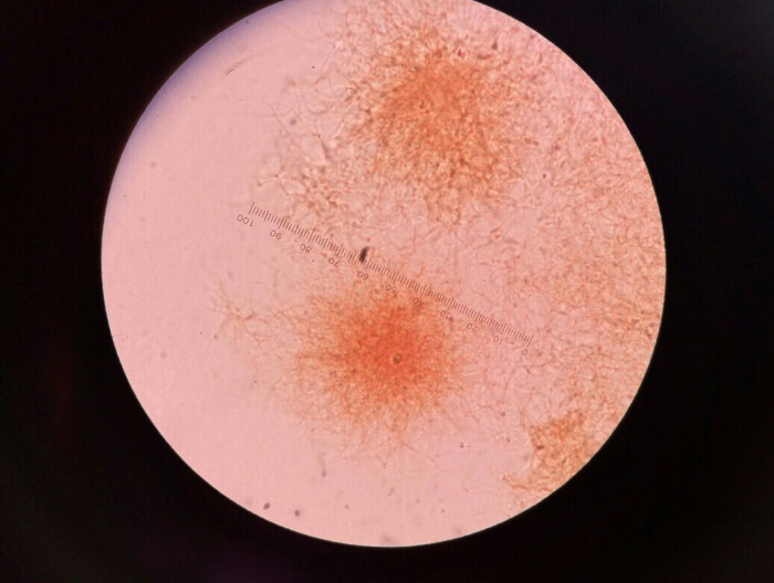放线菌显微镜 手绘图图片
