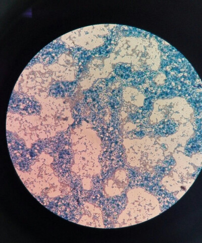 酵母菌显微镜下图片