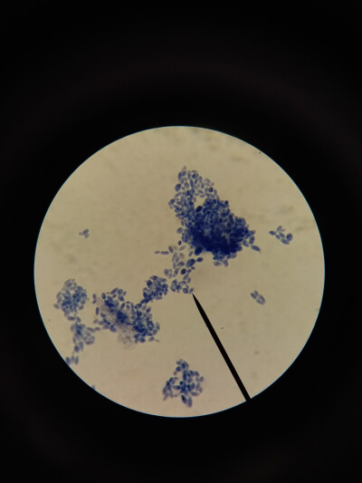 酵母菌显微镜下手绘图图片