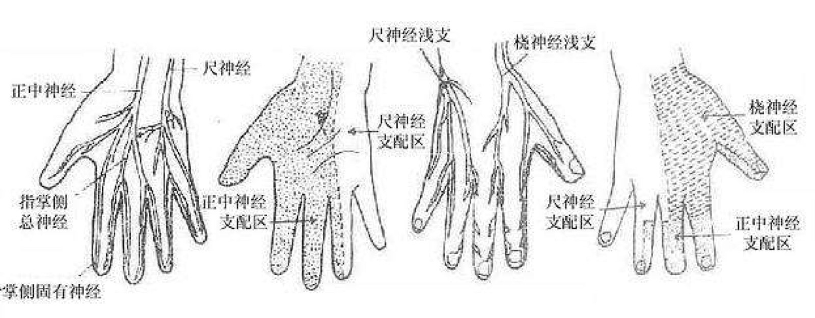 手部神经解剖图解图片