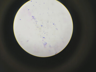 葡萄球菌显微镜下图片图片