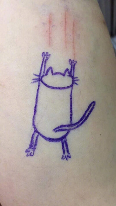 猫把主人抓伤,主人特意画了一只可爱猫来配合抓痕!by/fb/huyn th