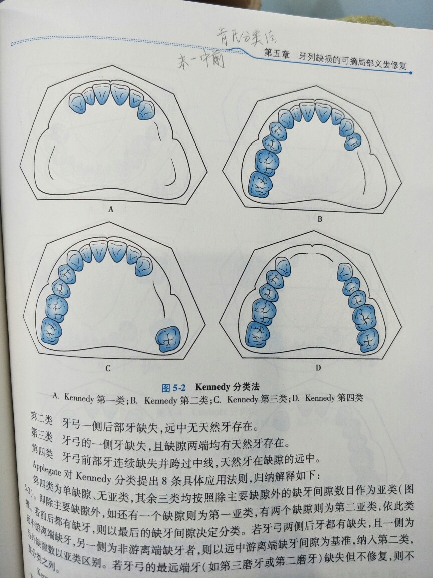 肯氏分类设计图片