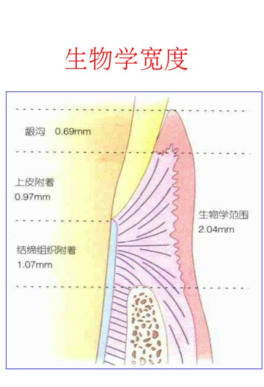 生物学宽度 牙齿