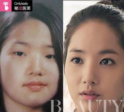 丑照又被网友扒出,因前后对比变化巨大被封为"整容最厉害"的韩国女星