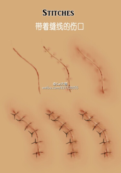 丶裂痕丶抓痕丶擦伤丶以及手速缝合伤口的画法参考素材】收藏转需~(by