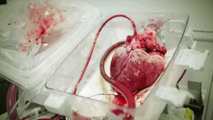 这是我们人类跳动的心脏.