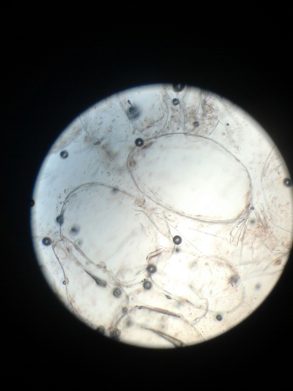 显微镜下的番茄细胞 初一买了显微镜:-))