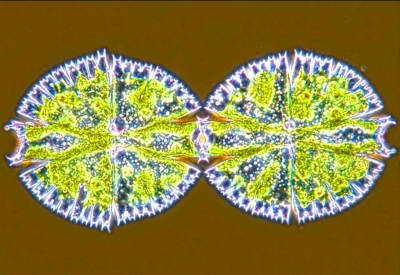 单细胞水藻的分裂图真是完美的对称,令人赏心悦目