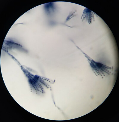 到  tc 图片评论 0条  收集   点赞  评论  显微镜下的草本植物纵切 0