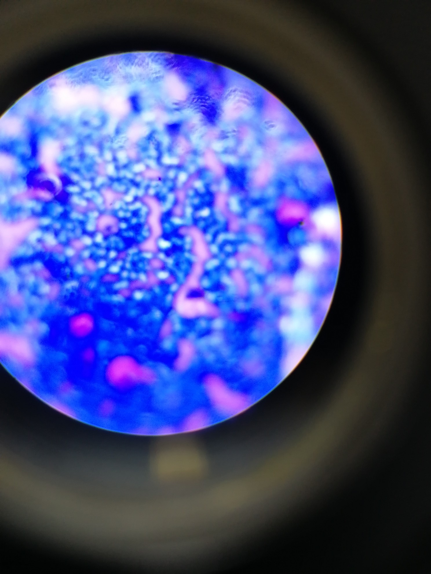 微生物实验 菌落 自存(="_"=)