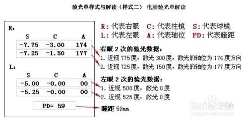 视力验光单怎么看度数