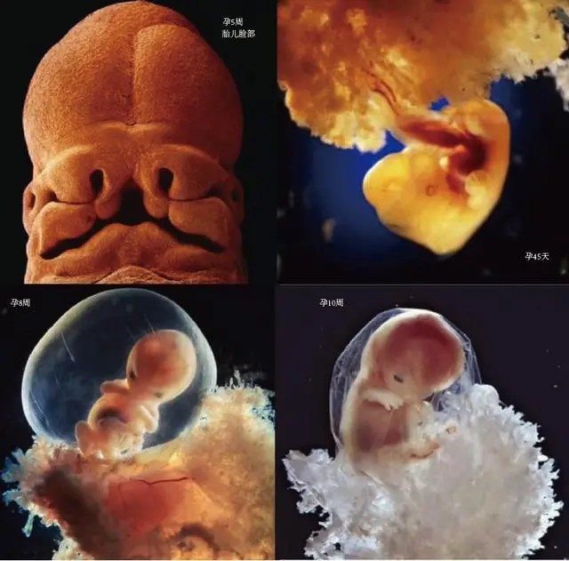 到了第10周左右时,胎儿的脸部发育更加完整,眼脸已经发展出来,只是还