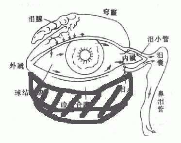 新生儿泪囊炎