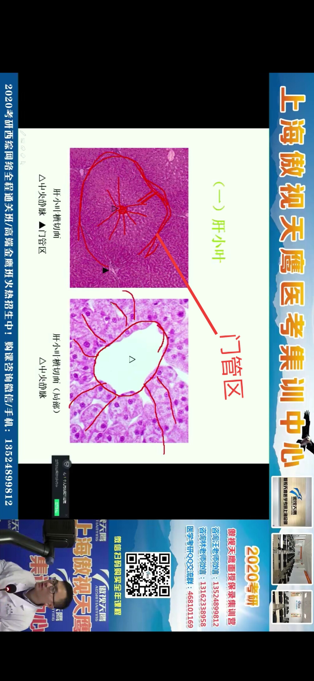 肝脏血流
