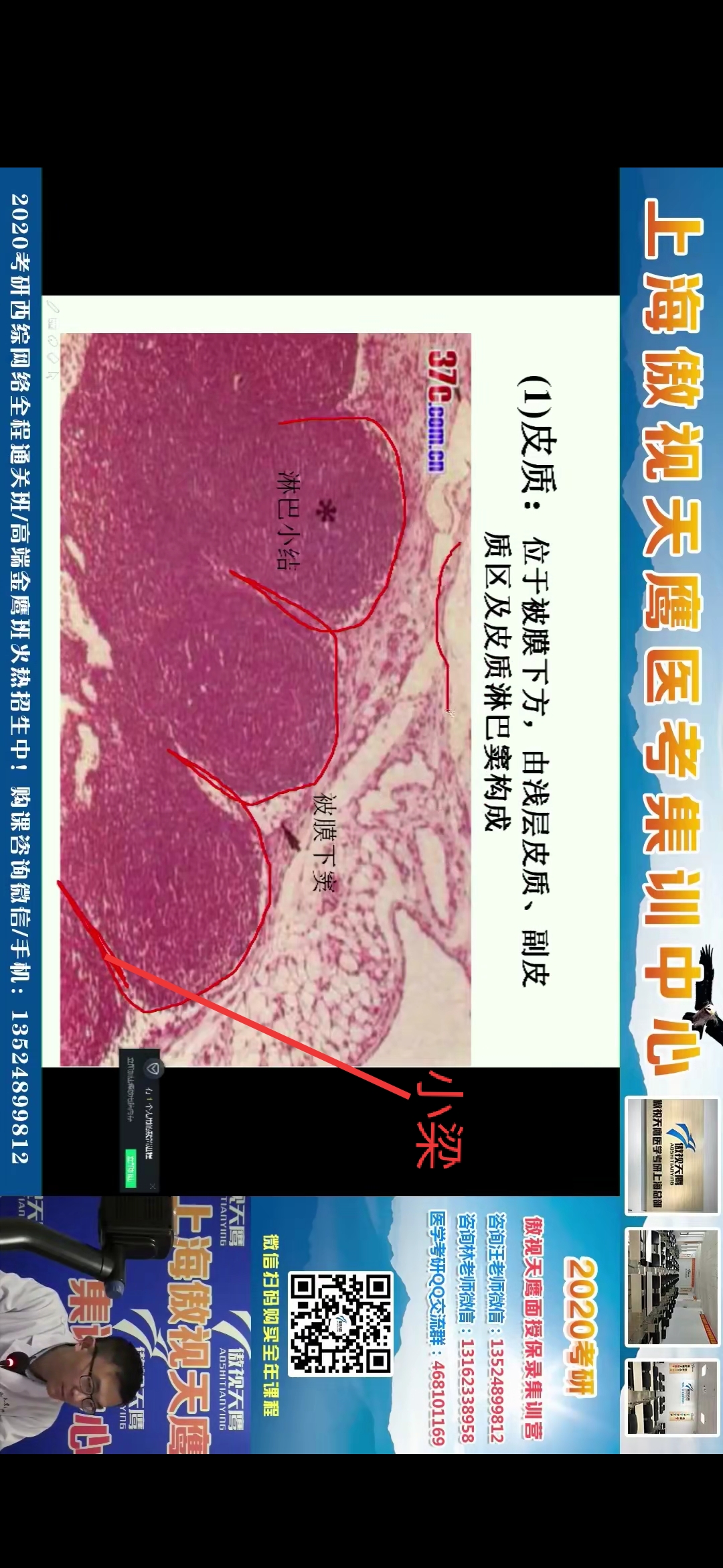 淋巴结- 堆糖，美图壁纸兴趣社区