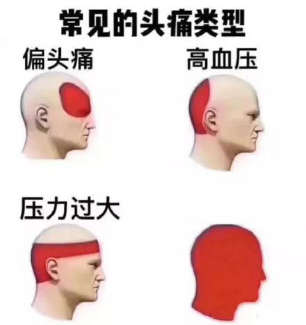 模板(偏头痛 高血压 压力过大)
